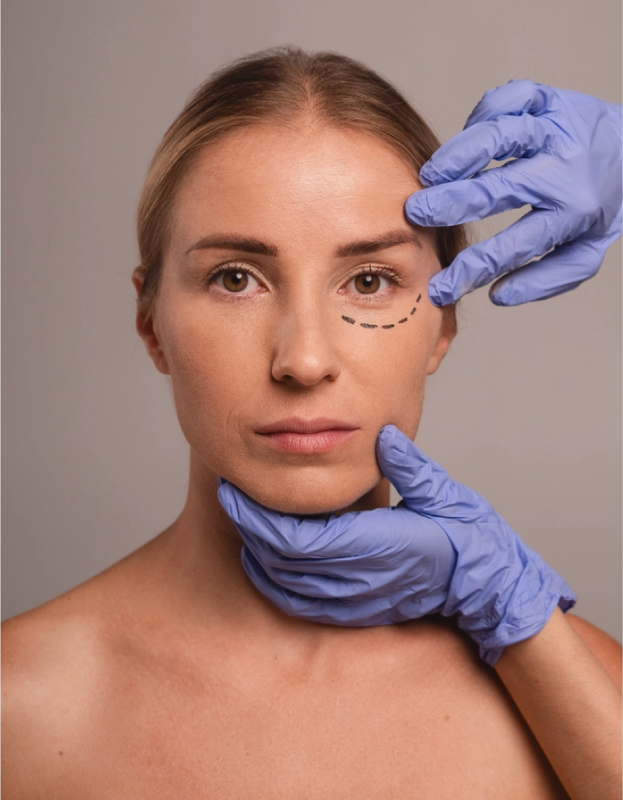 Blefaroplastia – Cirugía de párpados-cuevas-web