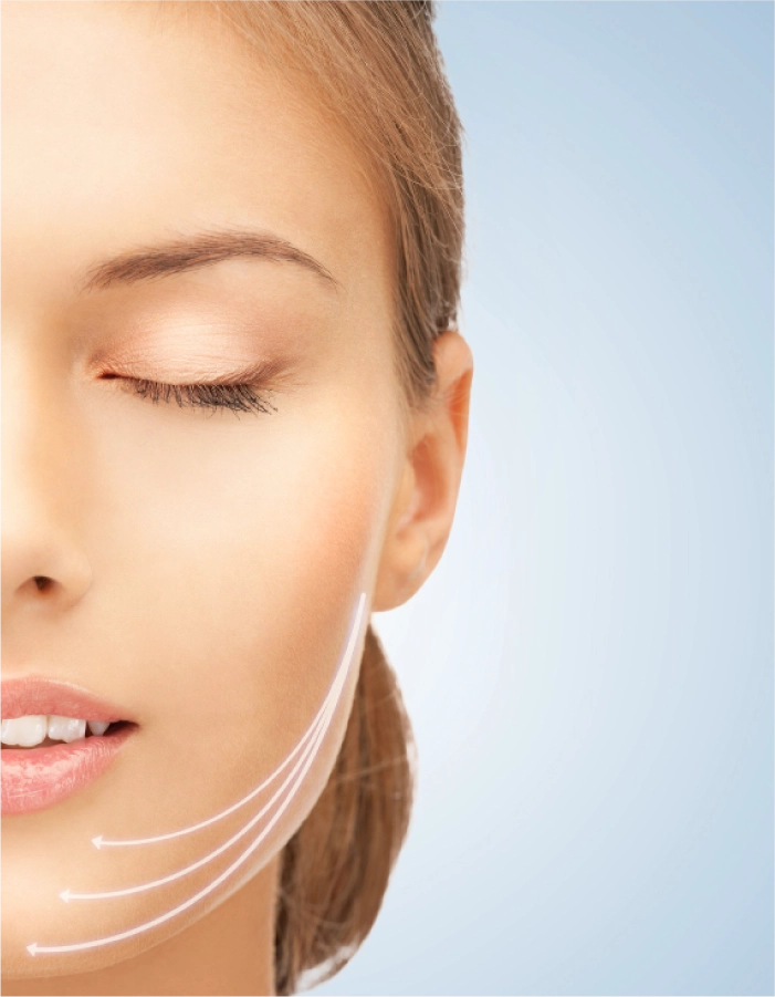 Hilos de Sustentación Facial