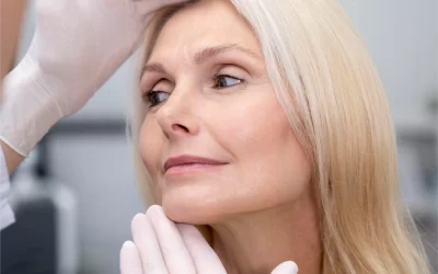 COMO MEJORAR LAS CICATRICES