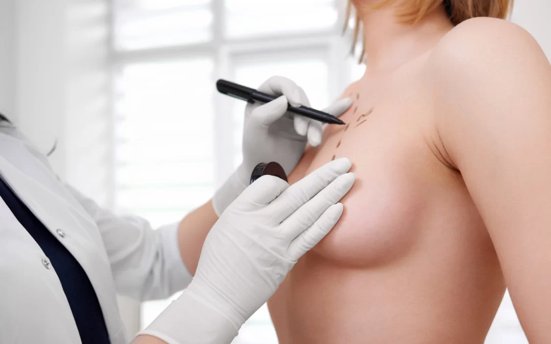 TIPOS DE IMPLANTES O PROTESIS MAMARIAS