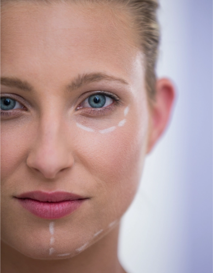 Ritidoplastia – Lifting facial o rejuvenecimiento facial
