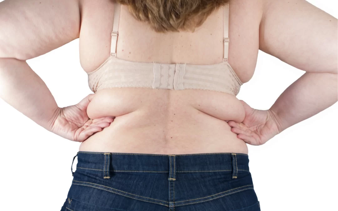 ¿CÓMO ELIMINAR LOS GORDITOS?