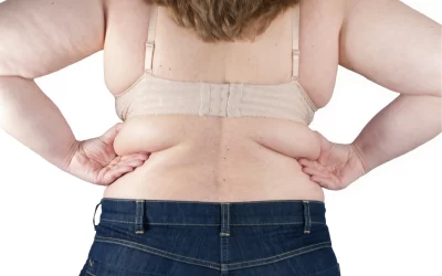 ¿CÓMO ELIMINAR LOS GORDITOS?