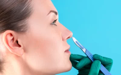 Rinoplastia sin tapones