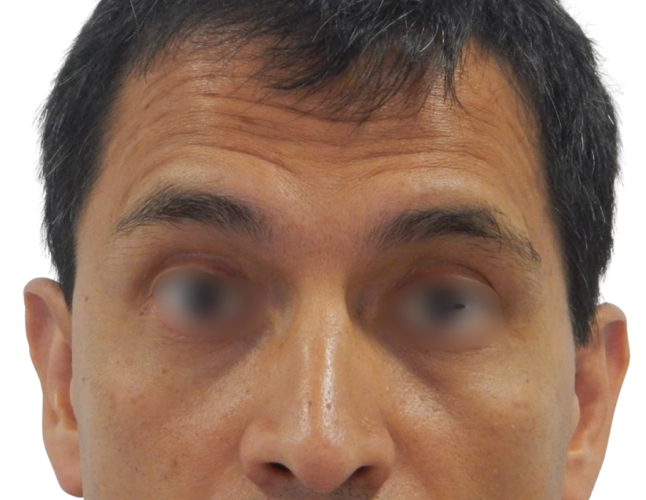 Paciente 01 antes