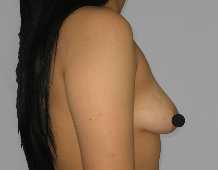 Antes Paciente 01 antes