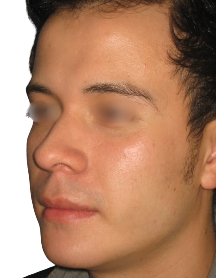 Antes Paciente 01 antes