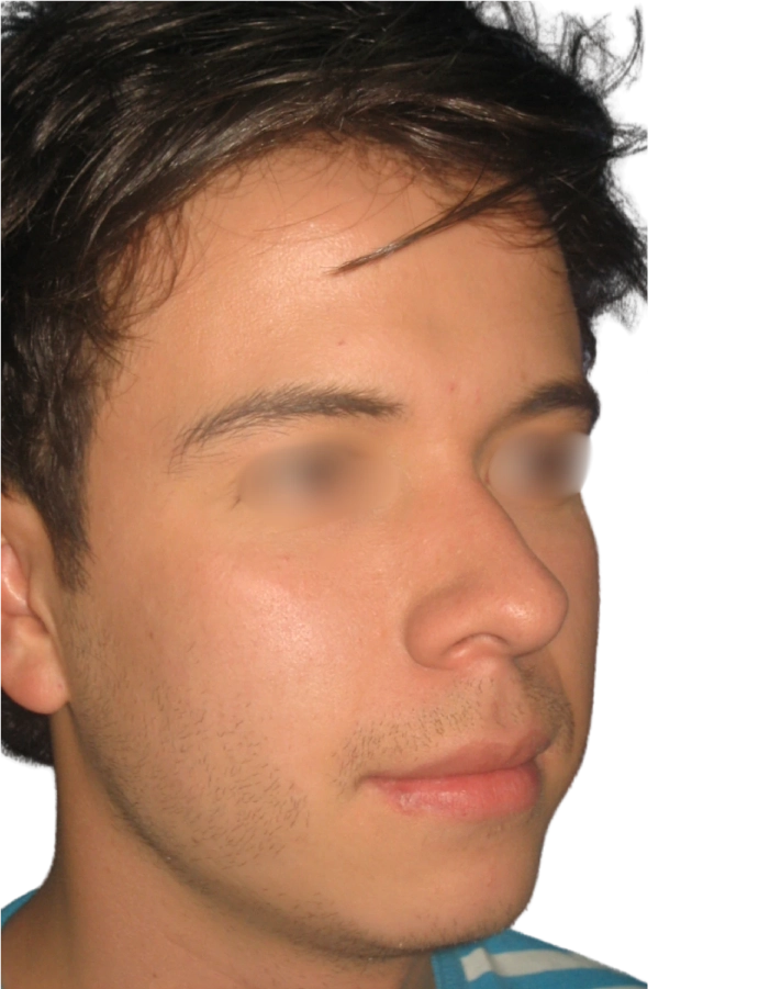 Antes Paciente 01 antes