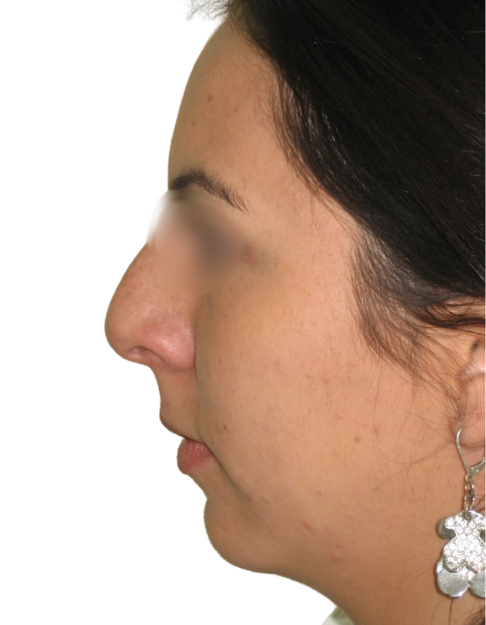 Paciente 01 antes