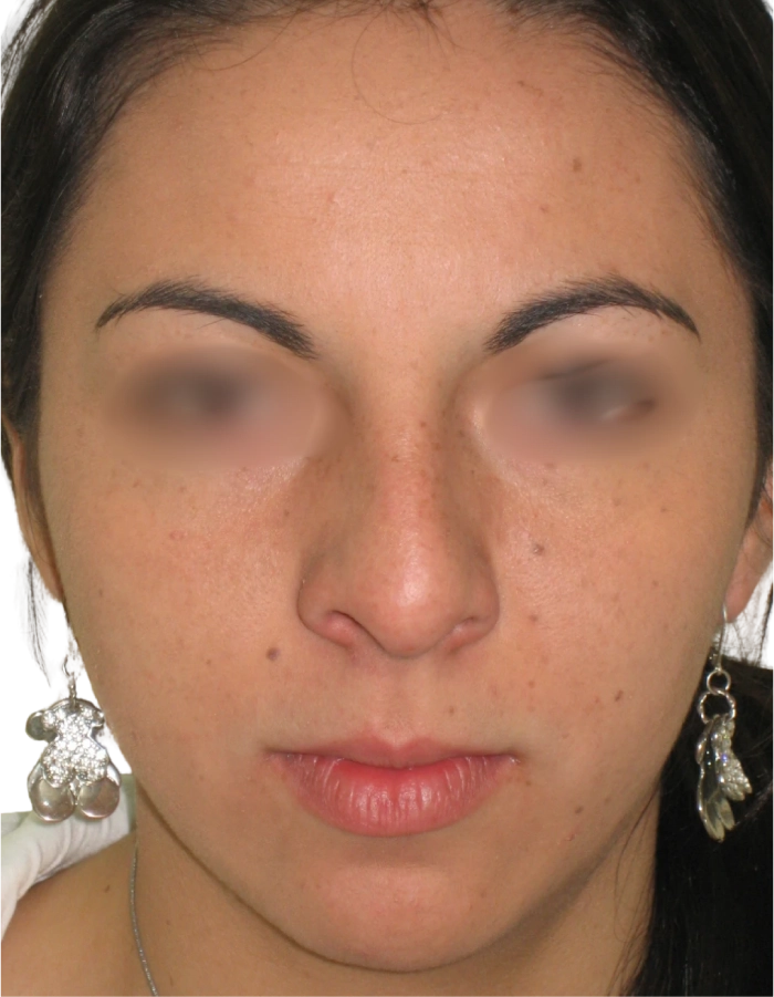 Paciente 01 antes