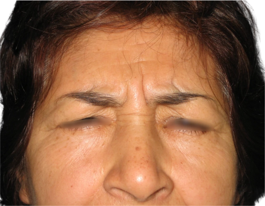 Paciente 01 antes