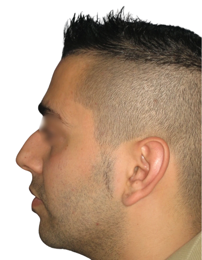Antes Paciente 01 antes